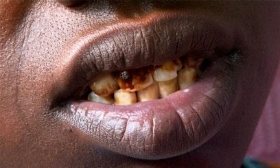 Abzz_aa's tweet photo. @AdamNyc @UGSP2 You’re literally a yaahudi slave who can’t even speak to me. You’re below any Muslim person in earth so i dont even know where u getting the audacity to speak. Keep crying from your two villages in north-east Somali with no water access in this big year💀 https://t.co/BSQ90Wq0uu