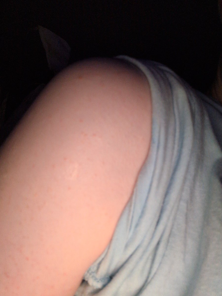 Alexium_270's tweet photo. Just dislocated my shoulder for the first time in a year fml. (Photo because why not. It doesn't show anything at all) https://t.co/bYT9opuji6