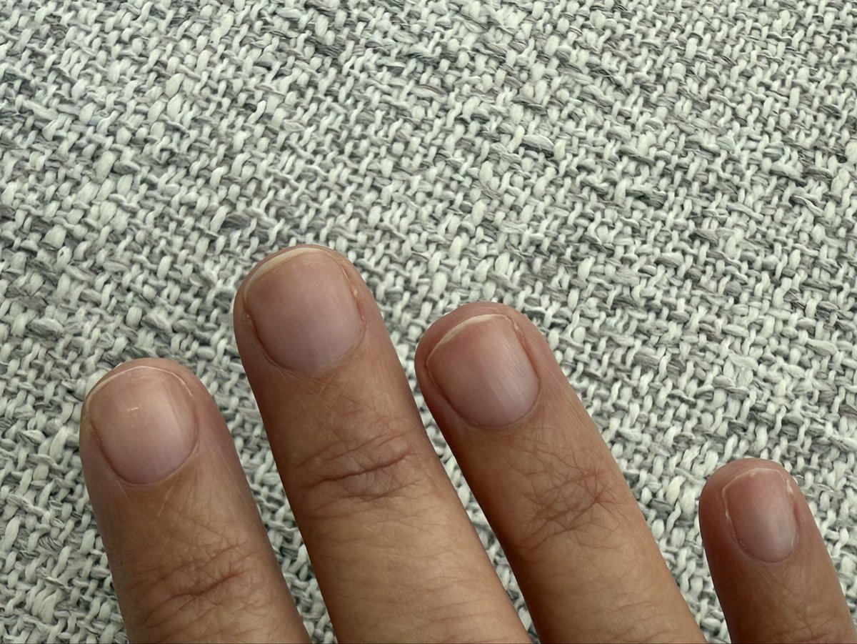 EnjoysAttention's tweet photo. Keeping them short for now 💅 
Light pink or white next? https://t.co/LY1ksWTlg7