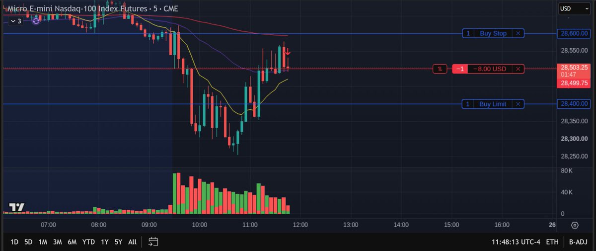 BuyOurTimeBack's tweet photo. Day 3 of Stacking points on NQ
Today we took a Loss -100pts on NQ with 1 MNQ contract. Full SL was hit today 
#fyp #smallaccount #tradingstrategy #buyourtimeback https://t.co/TFCPXxoRaV