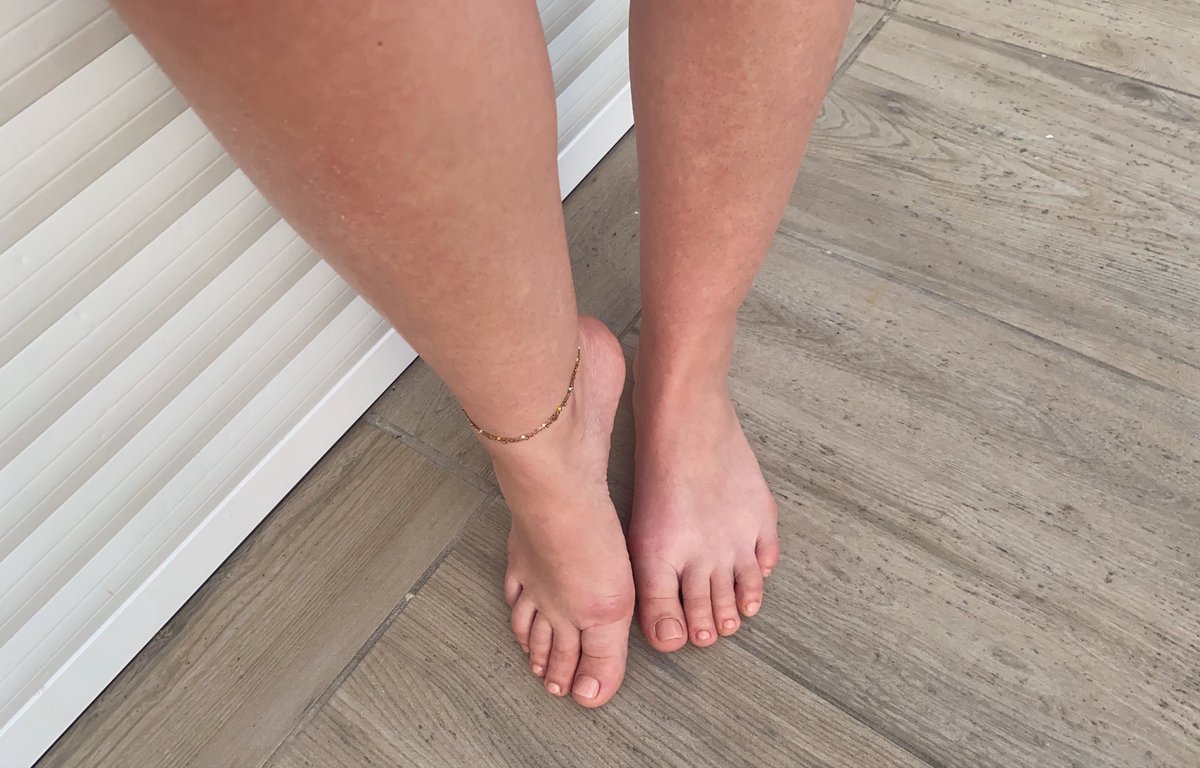 RoseDeureuson's tweet photo. Ils attendent d’être choyé 😋💋

#feetfetısh #feet #pieds https://t.co/rNxp6RMP1c