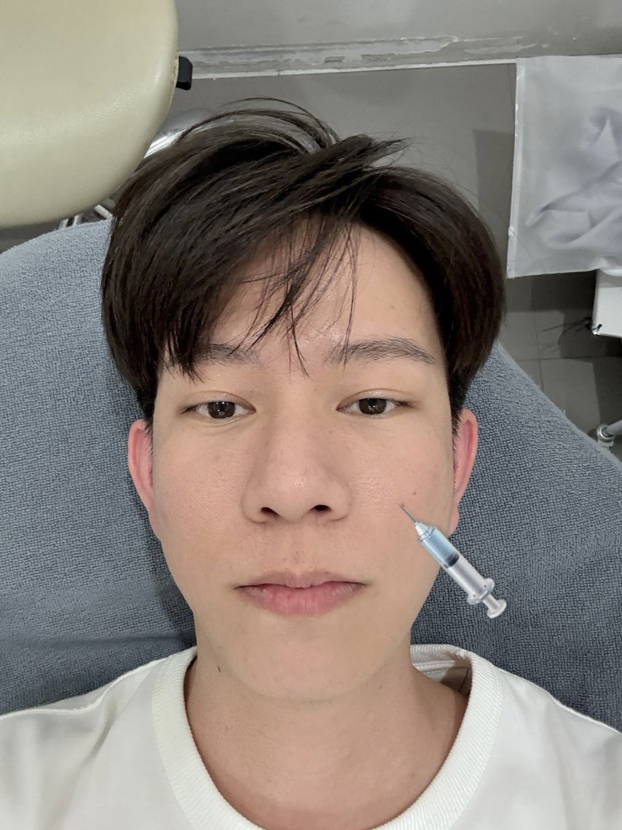 jay_thvnkrn's tweet photo. 📌 หลังทำ pico laser เสร็จ ควรใส่แมส แล้วให้รีบกลับไปพักหน้าที่บ้าน

ไม่แปลกใจที่บางคน หน้าอักเสบ เป็นหนอง มีรอยดำ เพราะหลังทำเสร็จเขาไม่ใส่แมสเลย

เดินเล่นแบบหน้าเปลือย ต่อให้เป็นในห้างก็ไม่ควร เพราะทุกที่มีฝุ่น ควัน

✅ หลังทำก็ควรดูแลรักษาตามนี้ครับ
1. ไม่ล้างหน้าใน 24 ชม. เพราะแผลยังสด
2. ครบ 24 ชม. ล้างหน้าด้วยน้ำสะอาด/น้ำเกลือ 1-2 วันต่อจากนั้น
3. เมื่อแผลเริ่มแห้ง ตกสะเก็ดแล้ว จะล้างด้วยโฟมที่อ่อนโยน/สบู่เด็ก ลดการระคายเคือง
4. เริ่มทากันแดดเมื่อแผลแห้งสนิท ไม่งั้นจะอุดตัน ทำความสะอาดยาก
5. ทากันแดดและใส่แมสจนกว่าผิวจะกลับมาแข็งแรง (แต่กันแดดต้องทาทุกวันนะครับ)