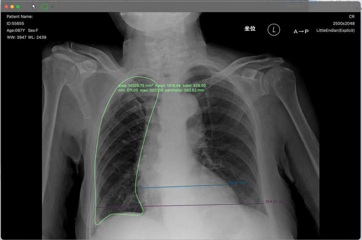 air_h_128k_ilI's tweet photo. ROI-color-rotation-UI も PHORLIX に持ってくる。
近日中に公開しますよ。
#dicom https://t.co/hpwIp9XRlP