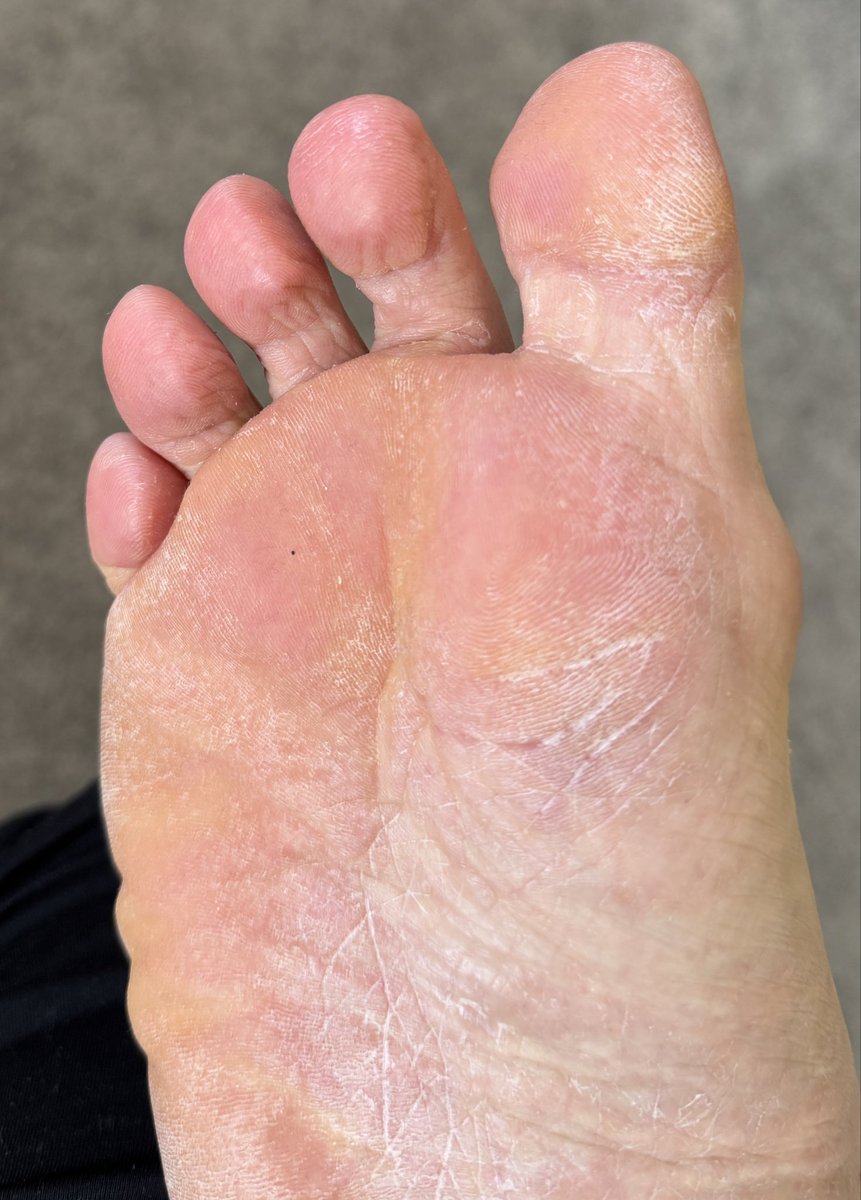 Real_NoFilter's tweet photo. Empty your wallet and show some appreciation…. Then get your nose in these and sniff the stink!
#footstink #smellyfeet #malefeet #roughfeet #dryfeet #throneappreciation https://t.co/mN9qfwqnIs
