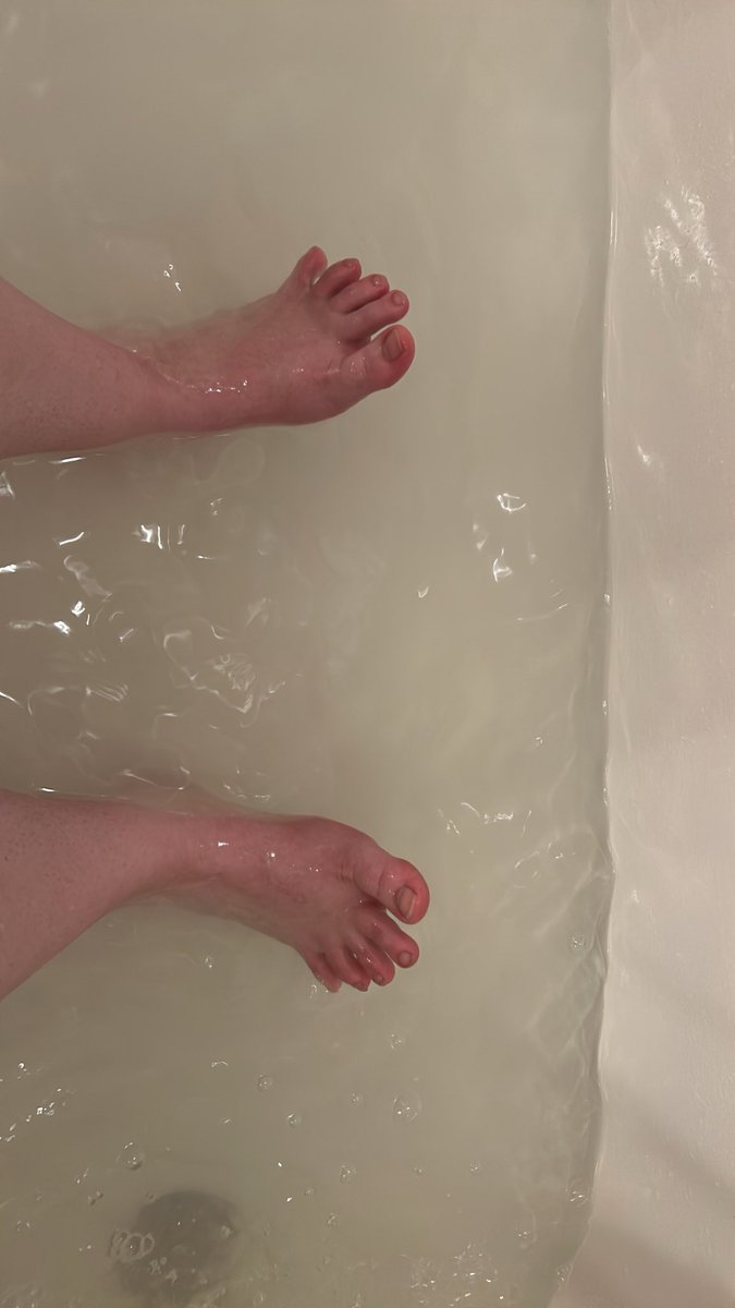 67phones's tweet photo. water so hot it makes the piggies red #WaterSoHotItMakesThePiggiesRed https://t.co/pmLnUsntIP