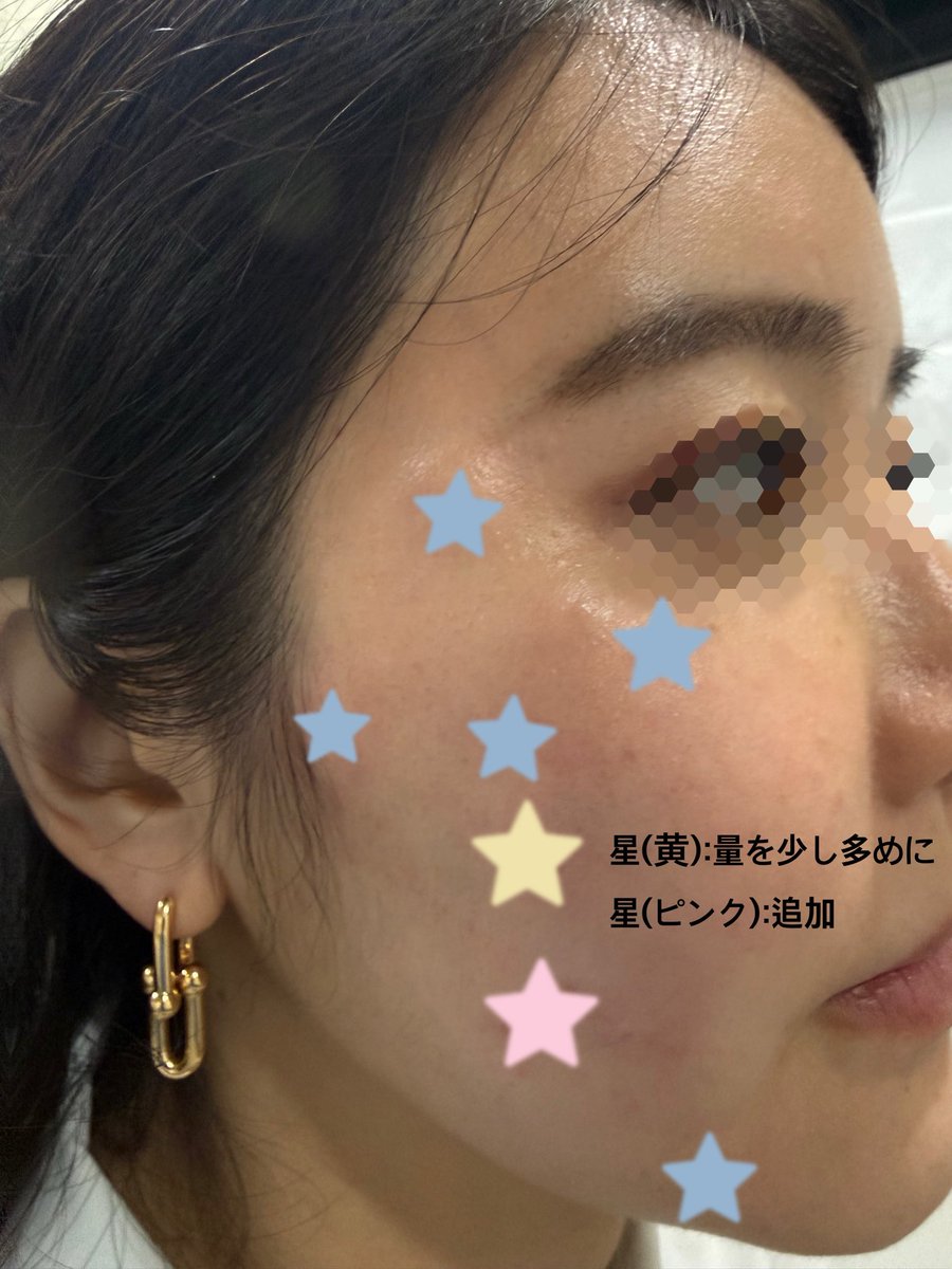 おおた先生|美容皮膚科医 tweet media