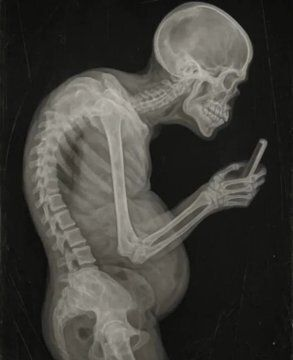 MZora0419's tweet photo. El cortisol no sólo te produce ansiedad. Está matando tu testosterona, almacenando grasa abdominal y arruinando tu sueño. 
Aquí te mostramos cómo apagar el interruptor del estrés y recuperar tu cerebro 🧵

1. Corrige tu postura. https://t.co/kPb79Dur6Z