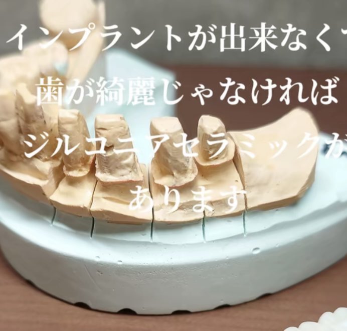 E39fVjOUVKrlqiK's tweet photo. Tiktokでセラミック専門医でどやってる歯科医師いるんだけ、絶対誰が見ても超下手。支台歯形成含めて。
チラホラ苦言を呈してるコメントを見るけど翌日には消されてる。
これがまた患者がﾒﾁｬｸﾁｬ多いんだわ。

とりあえず歯科医院名は分からないようにしました。 https://t.co/dWF4Qh0K0z