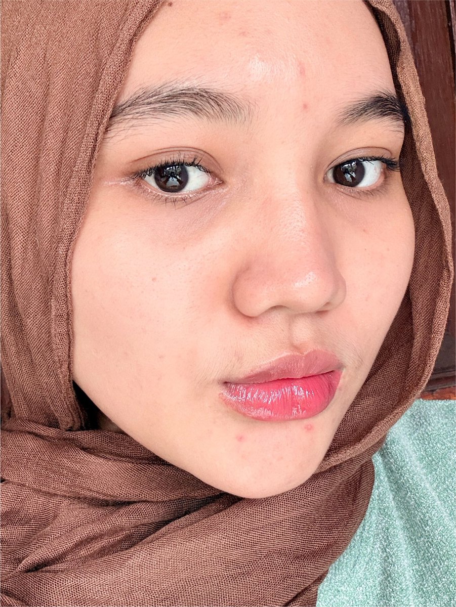 ssyabr's tweet photo. ga nyangka 😭😭 literally ini yg bikin jerawat aku KALEM dalam seminggu…

pori2 juga keliatan lebih rapi... PANTES RAME, TERNYATA INI BIKINAN ITB 🤯 https://t.co/NuOiKFqAIl
