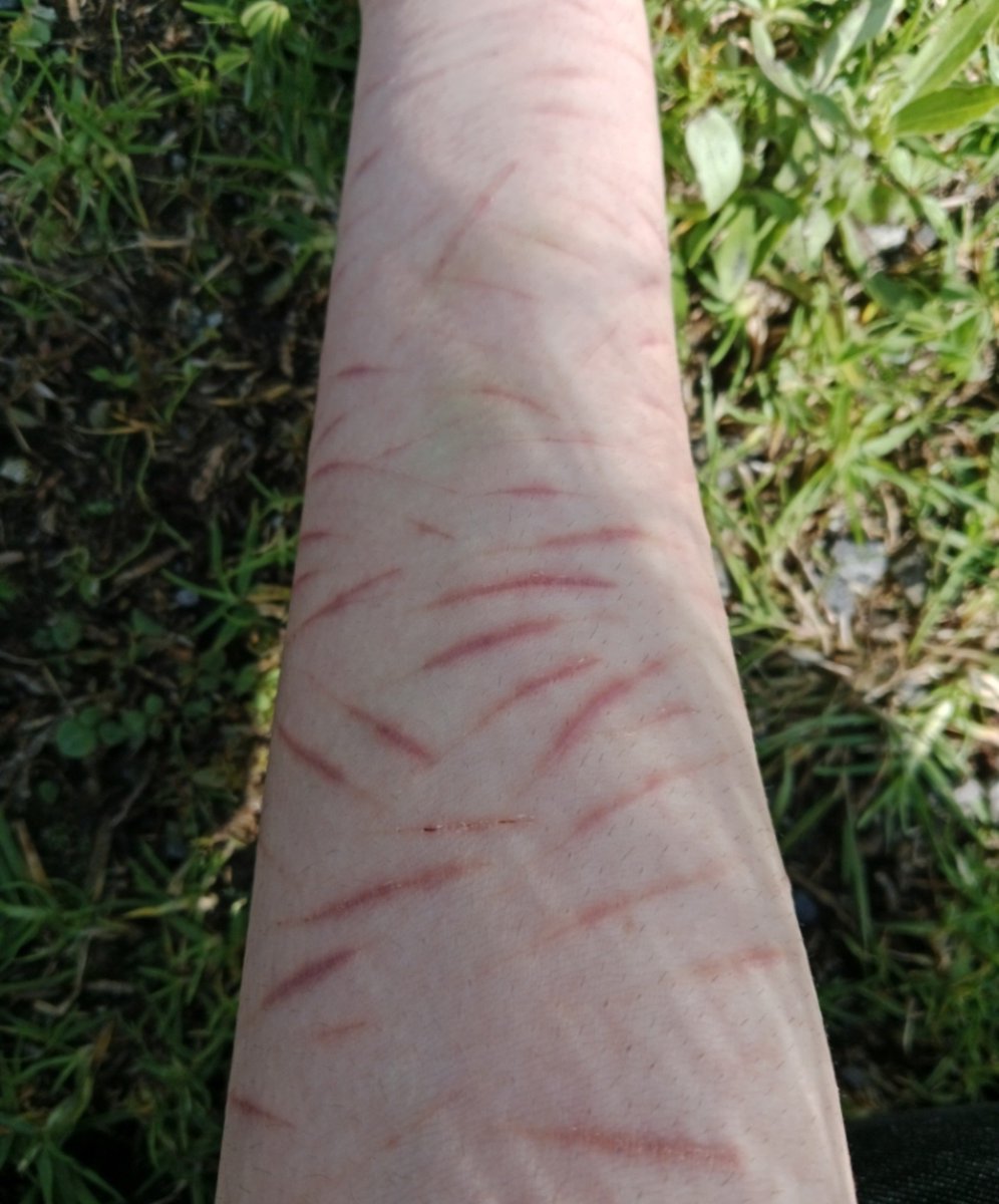 fiskpudding_'s tweet photo. I think I'm getting better at my SFX MAKEUP (FAKE) practices
#selfharm #slittwt #988twt https://t.co/HqRQKKdC74