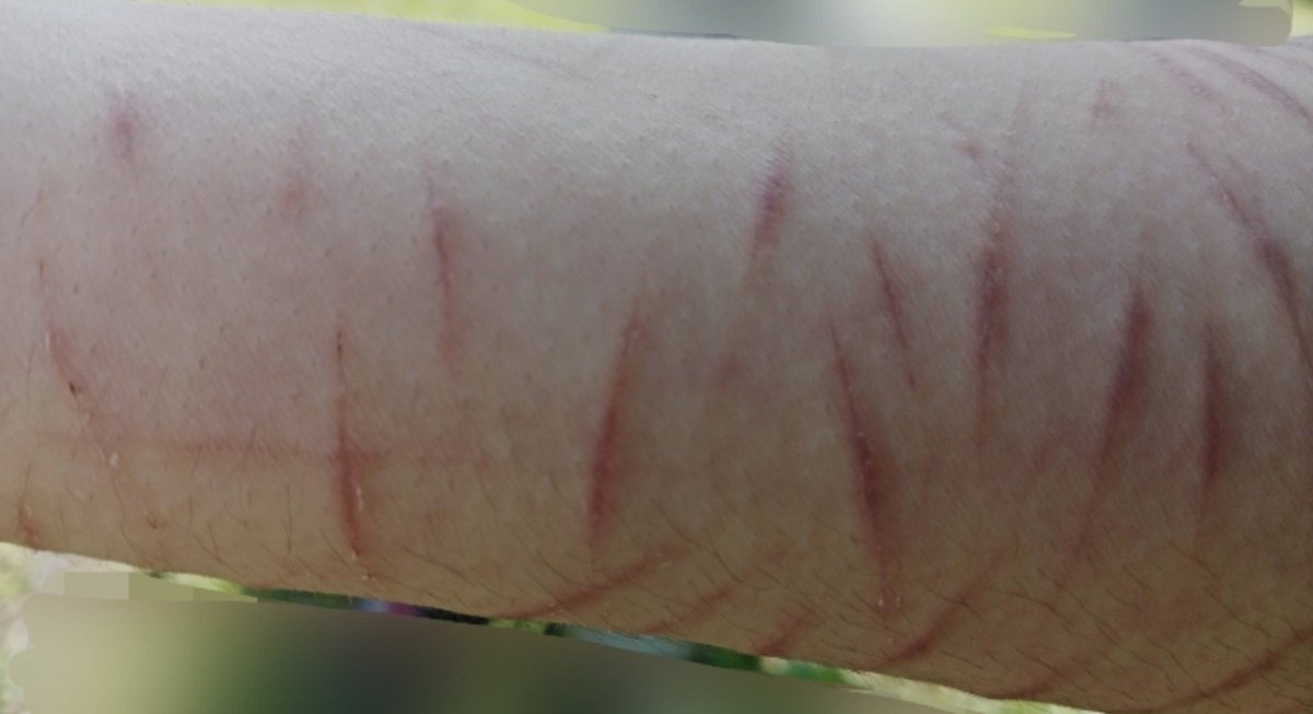 fiskpudding_'s tweet photo. I think I'm getting better at my SFX MAKEUP (FAKE) practices
#selfharm #slittwt #988twt https://t.co/HqRQKKdC74