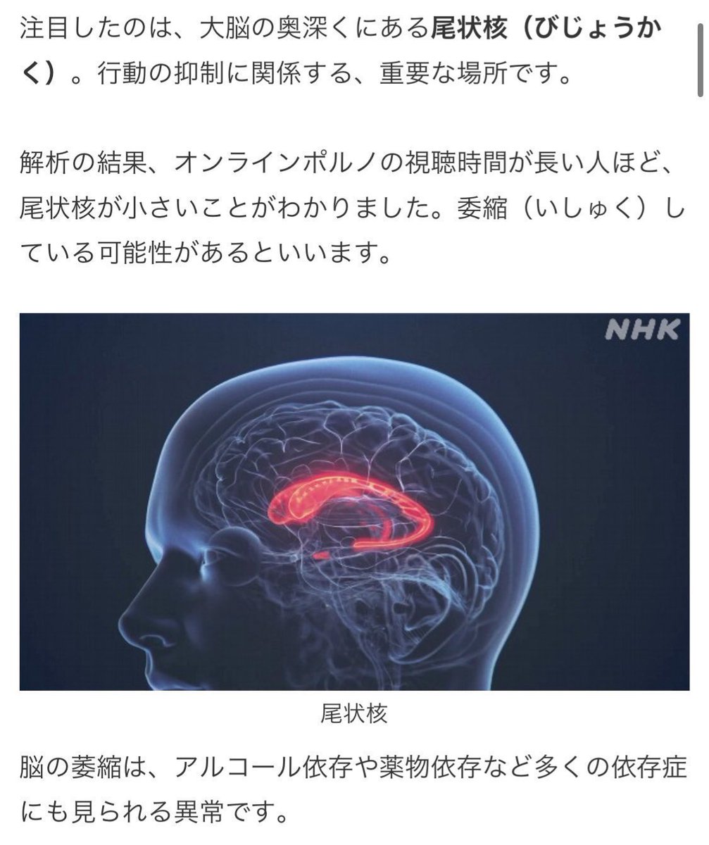 GRANDALARME's tweet photo. 「加害」「人権侵害」「女性蔑視」が普通の顔してあらゆる男性向けエロに入ってるし

さらにそれらを「普通のこと」「女が喜ぶこと」だと描いてるのが問題

例えるなら
"強盗された被害者が喜んでる描写"が普通になってしまってる、みたいなもの

現実的でないものが「現実的」だと描かれてるのが一番ヤバい

当然悪影響ありまくりだよ