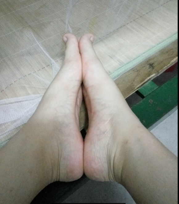 huangbaiye's tweet photo. 足穴 #足底 https://t.co/gMu0QeKsKB