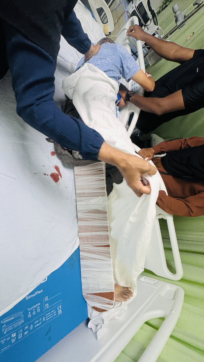 XefroX's tweet photo. ބާރު ސްޕީޑުގައި ދުއްވާފައި އައި ސައިކަލަކުން ޖެހި ބޮޑު ބޭބެގެ ސިކުނޑިއަށް ލޭ އަރާ، ފައިގެ ދެ ކަށިގަނޑު އެއްކޮށް ބިނދި ބޮޑު ވޭނުގައި އޮތް އިރު ބާރަށް ދުއްވި 19 އަހަރުގެ މީހާއަށް ރާއްޖޭގެ ޤާނޫނުން ސައިކަލު ޓޯކުރުން ފިޔަވައި ދެވޭމެ އަދަބެއްނެތް.

(1/2) https://t.co/MtrnHHJDO2