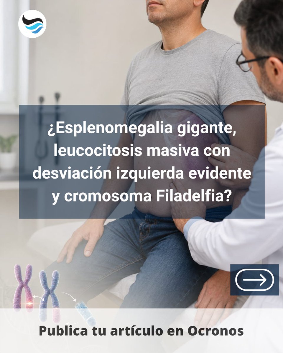 revistaocronos's tweet photo. Leucemia mieloide crónica: no todo es infección.
La FAG muy disminuida diferencia LMC de reacción leucemoide por infección grave.
¿La usarías como pista diagnóstica? 🧬 #Hematología #Medicina https://t.co/h3era58w5g