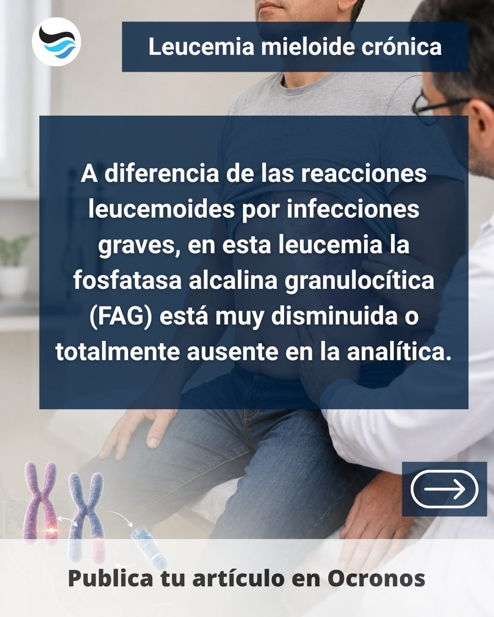 revistaocronos's tweet photo. Leucemia mieloide crónica: no todo es infección.
La FAG muy disminuida diferencia LMC de reacción leucemoide por infección grave.
¿La usarías como pista diagnóstica? 🧬 #Hematología #Medicina https://t.co/h3era58w5g