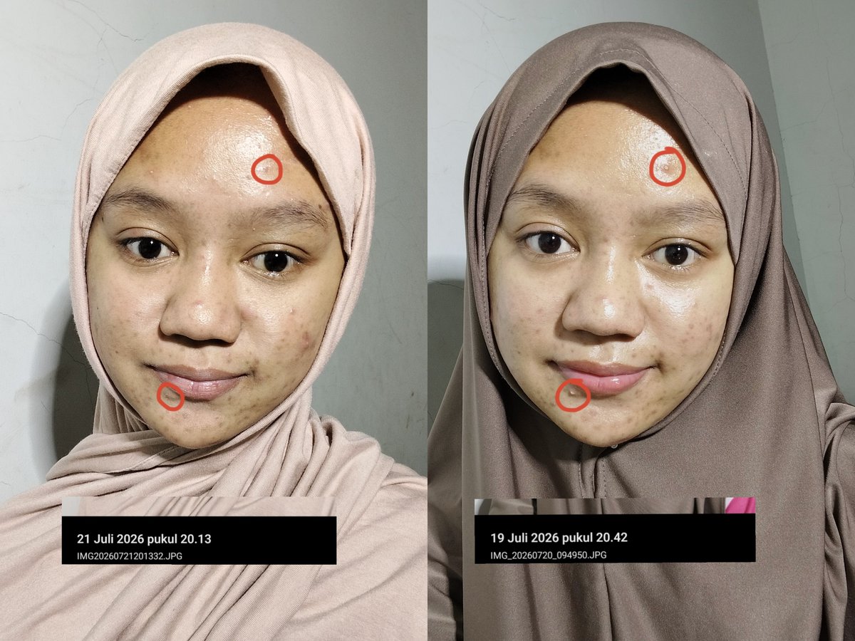 Ajeng Kholifah Aulia tweet media