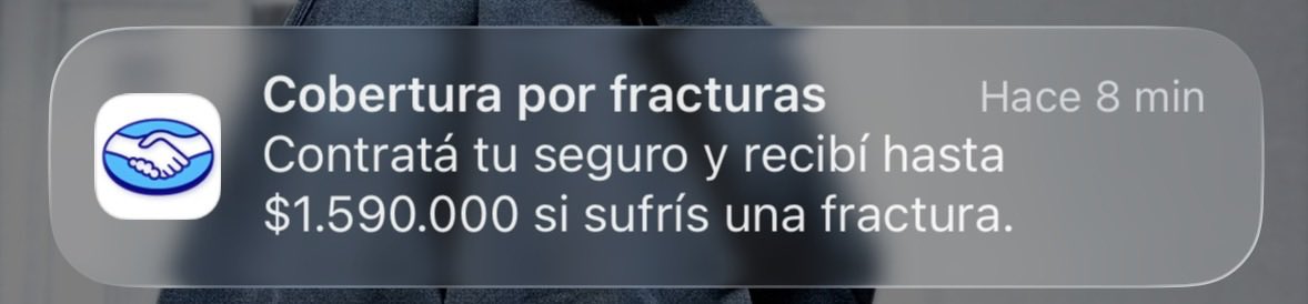 mintmintyg's tweet photo. Chicos nunca me fracturé, duele mucho? https://t.co/YOifhh5DNp