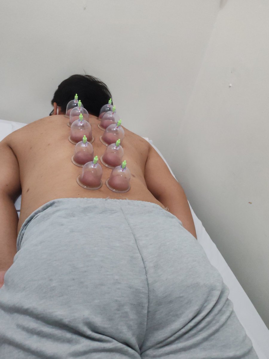 DaddyAL98's tweet photo. Done Massage📍 D'morvie CDO
Ventosa lang daw iyaha. Ty sa Tip Parekuy 🫶 Mga buotan kaau taga CDO❤️
Client#15 (7/27/26 @9pm)
#Davaoalter #Davaomassuer #davaomasahista #alterph #altertagum #alterdigos #altergensan #legitmasahista #cdoalter #altercdo https://t.co/3SrpvyFUpA