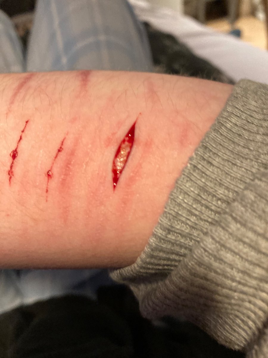 Idek_dudeee's tweet photo. @Meowcutie_0 Here’s my 100% FAKE SFX FOR A HORROR MOVIE ENHANCED WITH AI slash flash https://t.co/LBuBXI2nOz