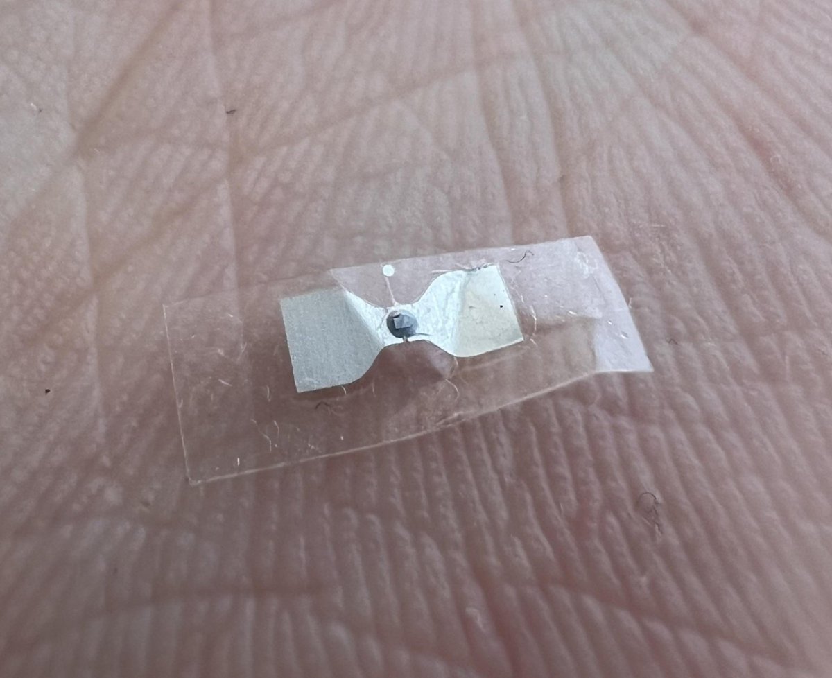 Avyansx's tweet photo. Hey @grok, I just found this tiny metallic chip on the back of my neck… what is this thing.? https://t.co/erlNRitqVw
