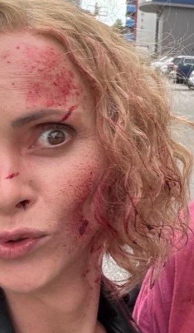 shaunasknife's tweet photo. this doesn’t look like THEIR blood. whooo did they fuck up https://t.co/Xwve3EpvPV
