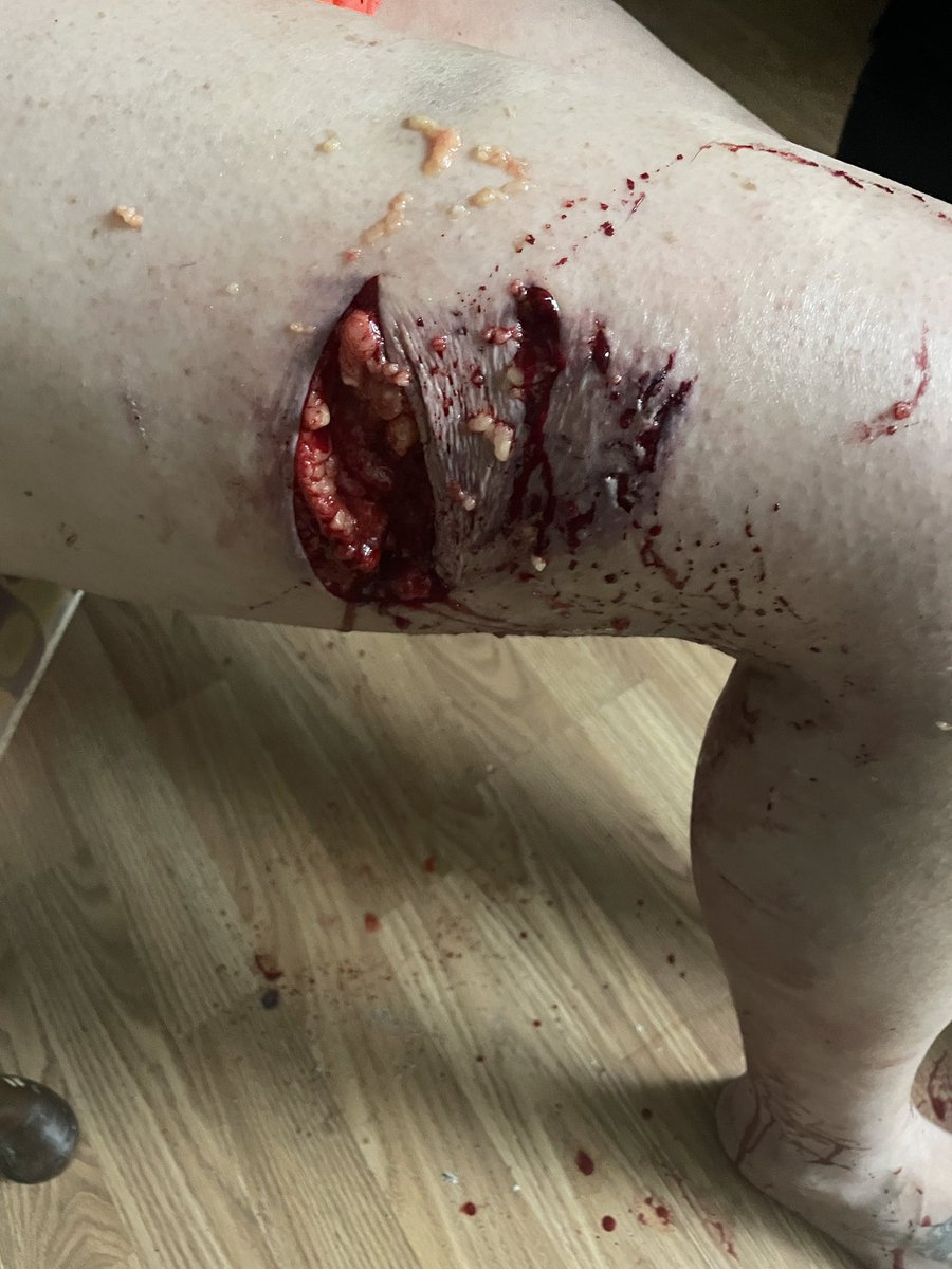 OKelly_Ron's tweet photo. @Maulop0101 @IncidentScope Because they can do this https://t.co/7LHjGMkamZ
