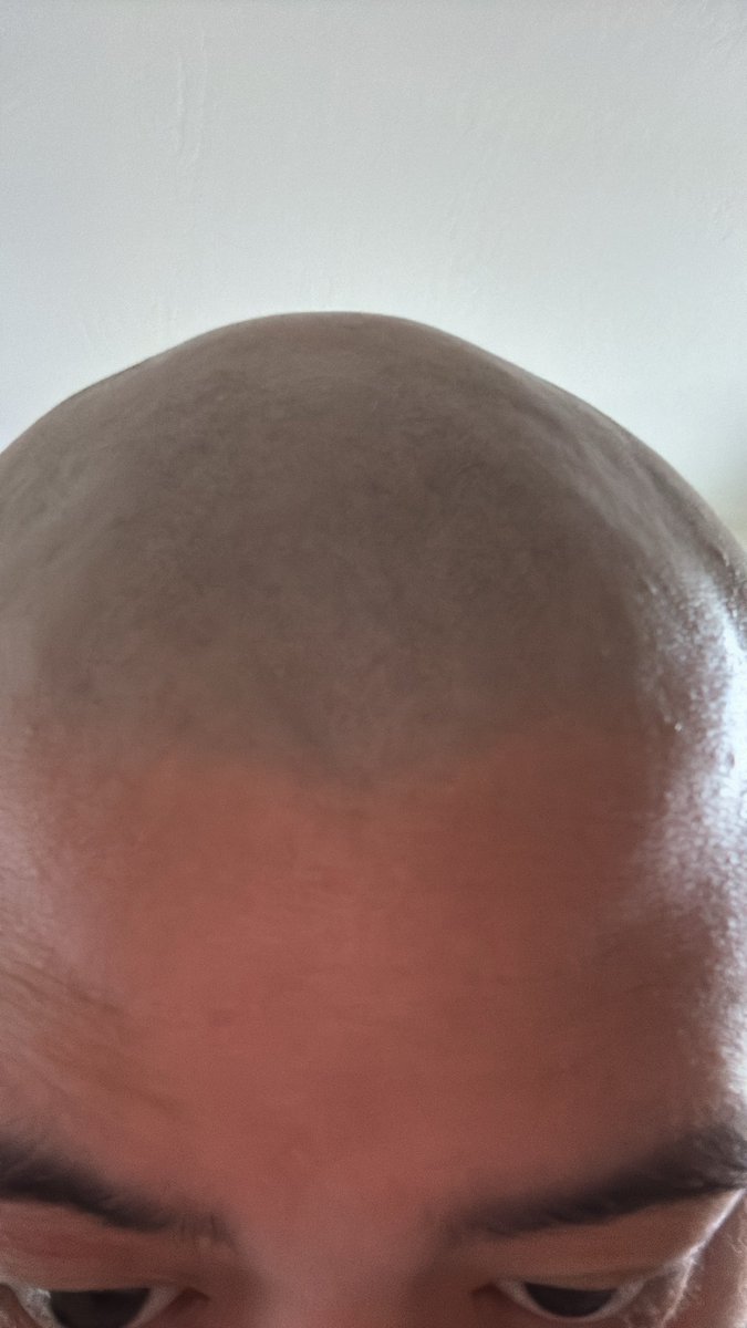 itsWilsonFung's tweet photo. @beegbuns really? 🥺👉👈 i just shaved too :D https://t.co/bhKUdLMveZ