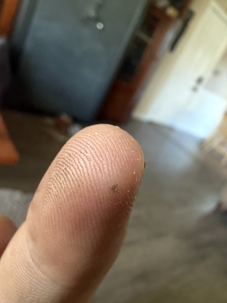 TankC60587's tweet photo. Shit just got a metal sliver in my finger while working on the rzr looks like it’s time for surgery where’s the whiskey 🥃 😂🤣😂 https://t.co/3dJoGxATIQ