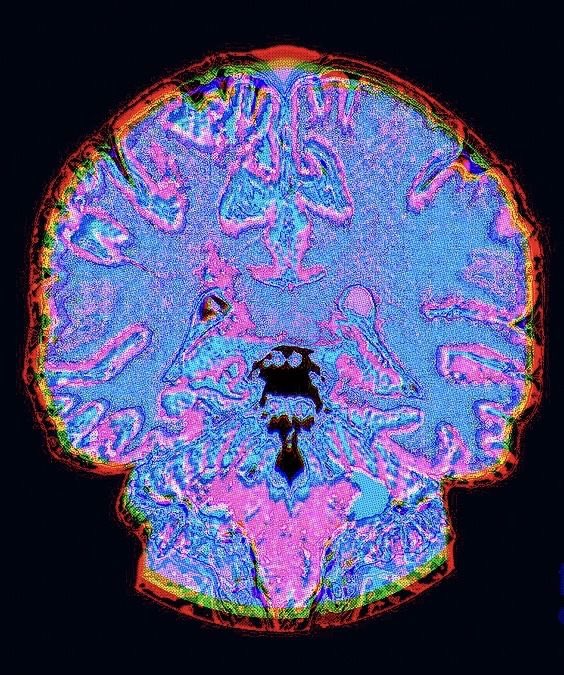 NightSkyToday's tweet photo. JUST IN🚨: Sour candy actually helps with panic attacks. The extreme sharp flavour can aid in grounding you to the moment and distracting you from the negative emotions. https://t.co/wVQxuZELSa