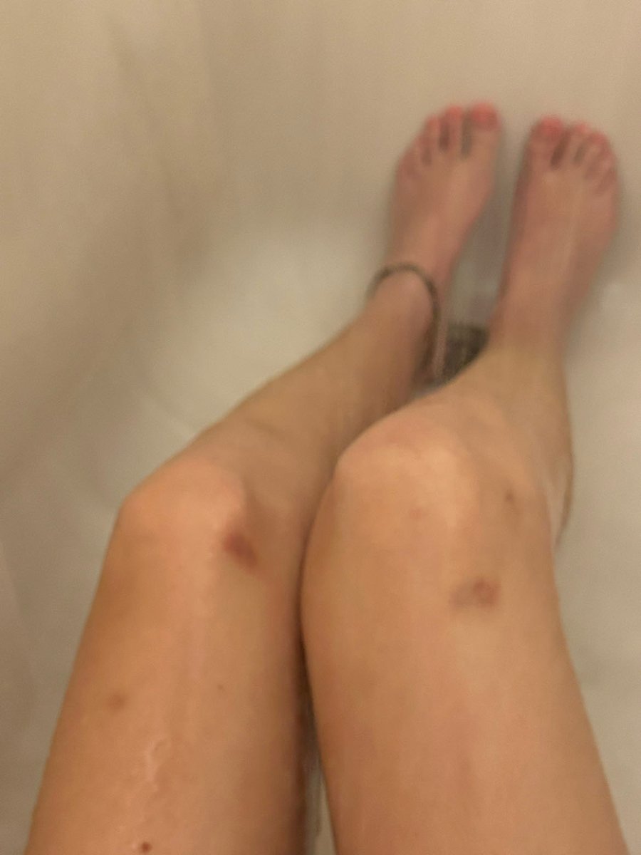 kittenviv06's tweet photo. Daddy always has me on my knees #daddy #sub #puppyplay #bdsm #bruises #rape #dom #forced #bj #facefucked #throatgoat https://t.co/iwkyz9rcq9