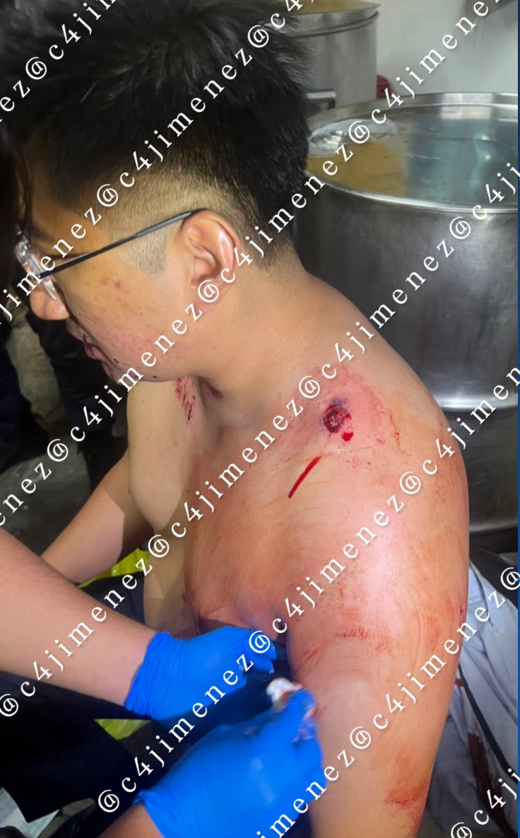 c4jimenez's tweet photo. DETENIDOS ACUSADOS de DISPARAR al DIR de ADMINISTRACIÓN de @GobMilpaAlta 
Víctor Rodríguez
Álvaro Rodriguez
Viajaban en el auto usado para atacar a Adrián Vilchis afuera de su casa.
Le dieron un tiro en el hombro y escaparon.
Agentes de @SSC_CDMX los ubicaron y detuvieron. https://t.co/wjLslRYpmk