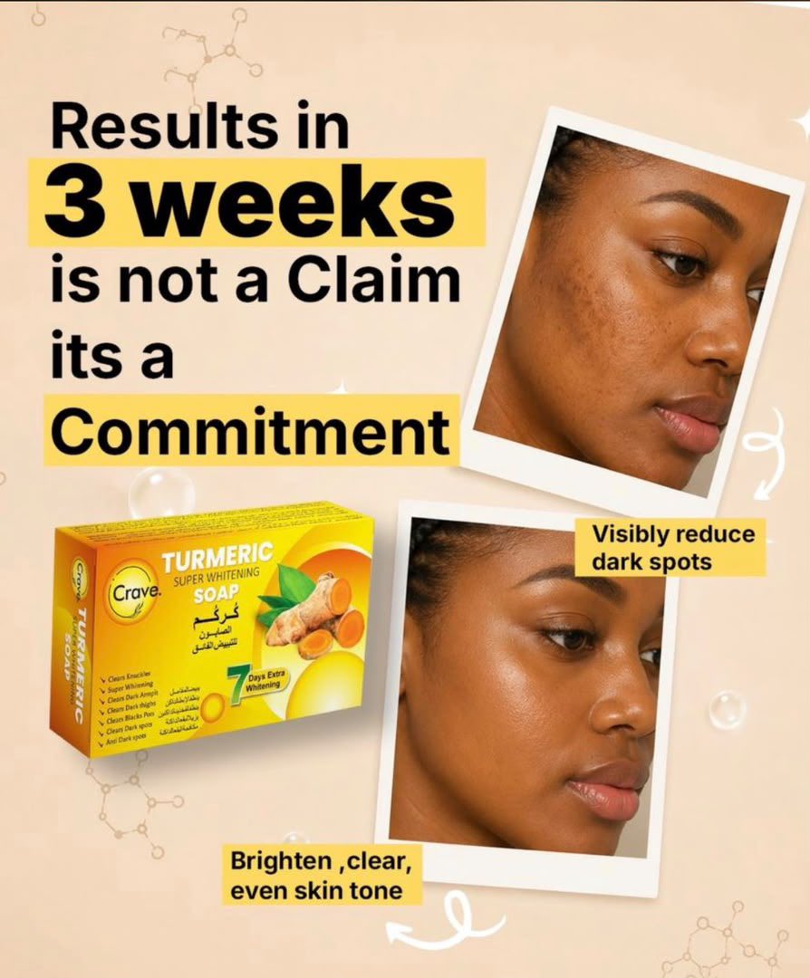 CraveGroup's tweet photo. Shop 🛍️ with us Today! ❤️❤️🎈 @ ( Shop 1 Edikean plaza opposite Kano after akwaibom plaza, Tradefair Complex, Lagos)

kindly contact: 07042614318, you will be responded to quickly https://t.co/7JPD7WDOpz