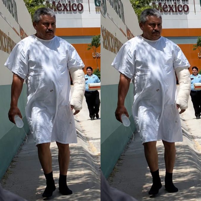 PuntoSuresteOf's tweet photo. Gabriel Castillo abandonó el nuevo Hospital General “Dr. Agustín O’Horán” con el suero aún conectado y un brazo enyesado, al asegurar que pasó horas esperando sin recibir estudios, medicamentos ni la atención médica que necesitaba tras sufrir un accidente. El paciente afirmó que prefirió buscar ayuda en otro lugar antes que seguir esperando.

El caso desató críticas en redes sociales y reavivó el debate sobre la calidad de los servicios públicos de salud. Mientras las autoridades esclarecen lo ocurrido, las imágenes y el testimonio del paciente contrastan con las promesas oficiales sobre el sistema de salud y han generado indignación entre la ciudadanía. 

Tal como lo dijo @lopezobrador_ y @Claudiashein el sistema de salud mejor que Dinamarca 🤡