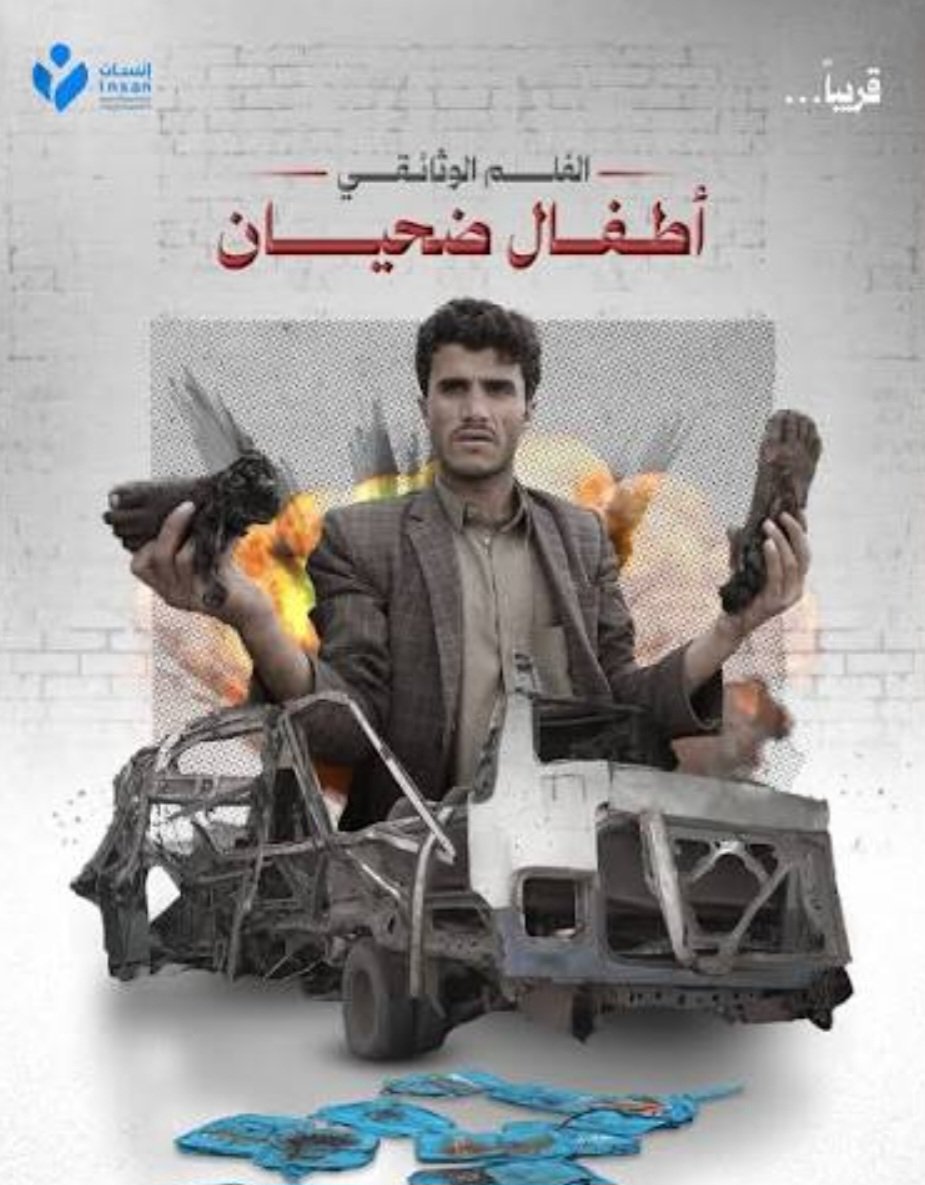 8a4lut's tweet photo. @Droptrend_ @hsom67 تفضل السعودي يحرق وطنك لكن مايصيبة اي ضرر وش اسمي هذه الحالة عبودية اما ماذا لا أدري والله.بس احب أخبرك ان اليمن لايتشرف فيك ولا تنتمي الية لذلك بطل الحركات هذه وشيل العلم اليمني وغير اسم حسابك مانا نعم اكرة السعودية بشكل لا تتصورة ليش شوف الصورة👇 اللي بيد الشاب ارجل اطفال بلدي https://t.co/ciPz1hG2MB