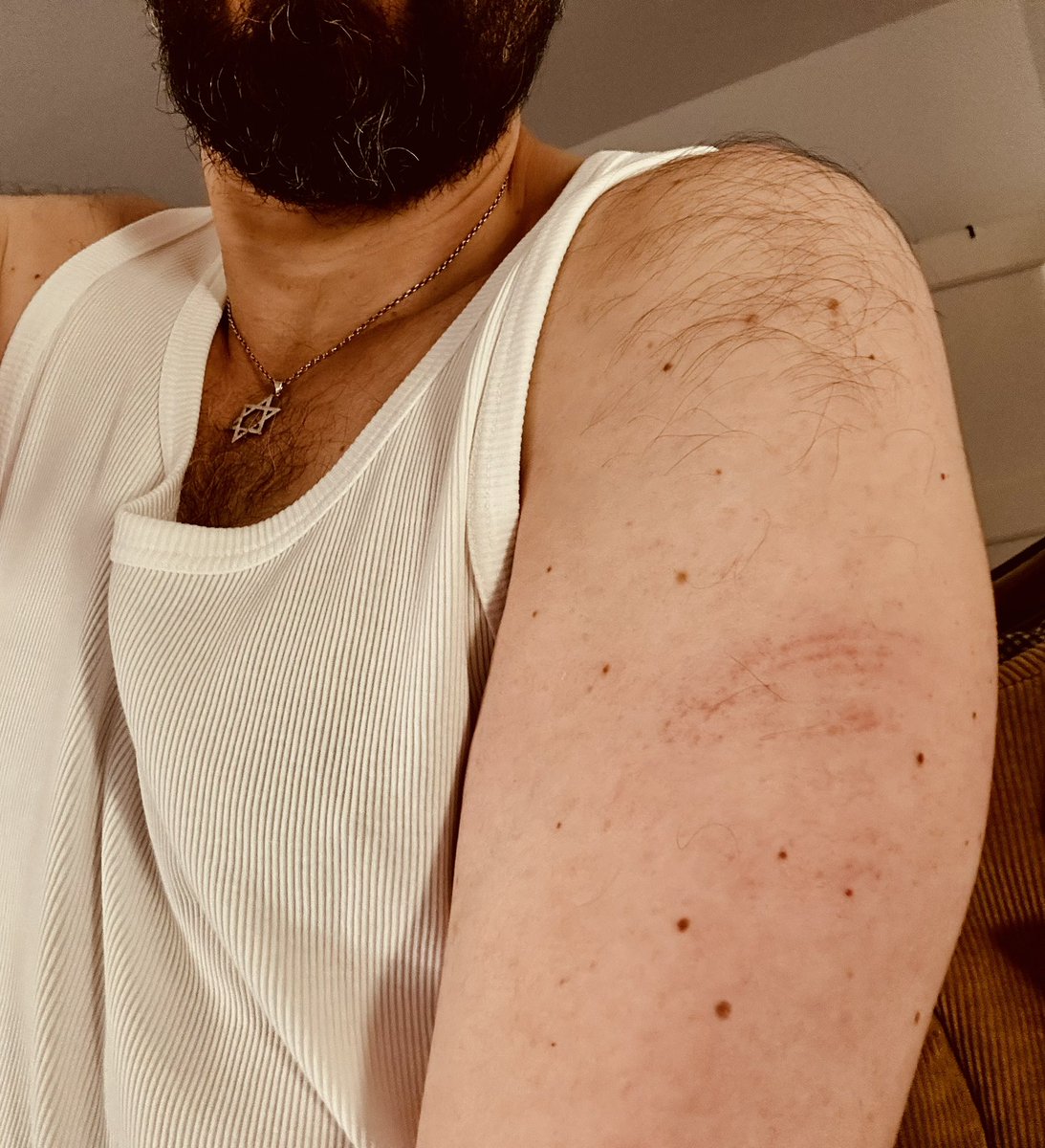 lindepemarica's tweet photo. Avui he patit la meva primera agressió antisemita a Berlín. 

Sortint del supermercat, un musulmà barbut m’ha agafat del braç cridant «rata jueva,maricó de merda». Ha intentat endur-se’m. Porto el braç esgarrapat, 

S’ha aturat quan he començat a cridar. Uns vianants m’han salvat https://t.co/m5lWFzcgUS