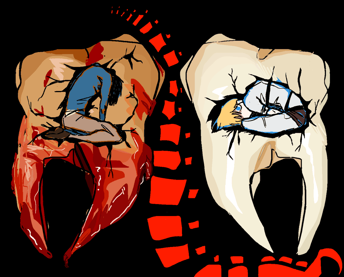 oranjeguices's tweet photo. it’s just a cavity man nothing to be ashamed of #aot #arminarlert #bertholdthoover https://t.co/Jd7YQwwPsb