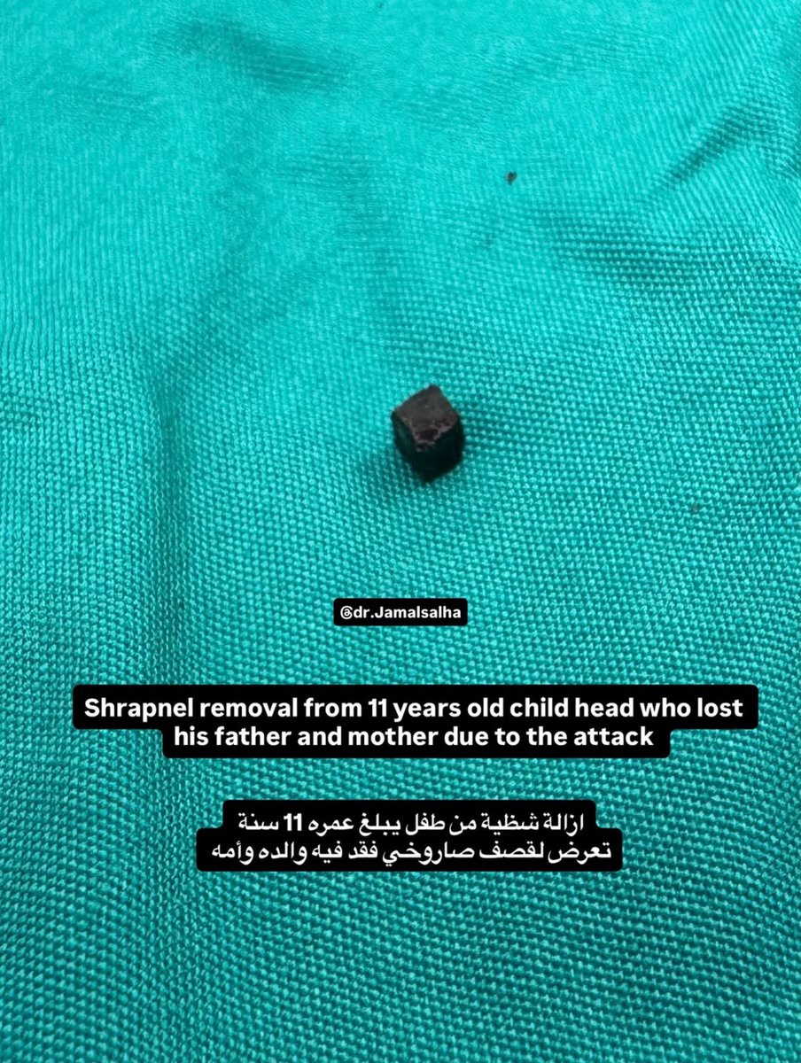gazanotice's tweet photo. 🚨A fragment of an Israeli missile was removed from an 11 years old boy’s skull.

Gaza’s doctors successfully performed delicate neurosurgery to remove shrapnel from the head of an 11 year old child who lost both his mother and father in the same Israeli attack that wounded him.