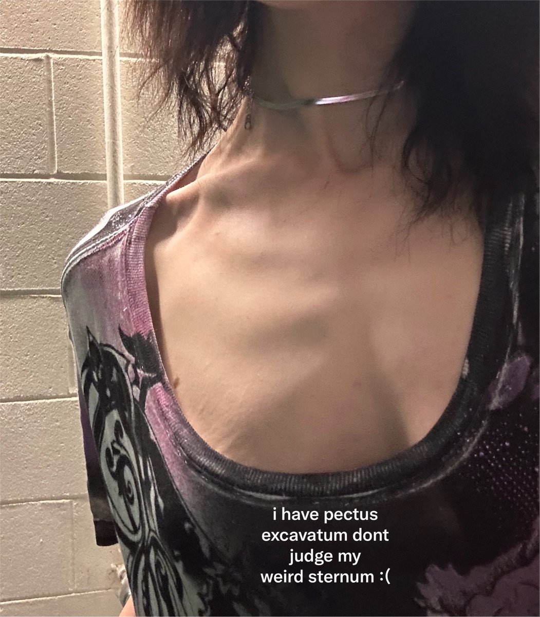 ponypuuke's tweet photo. feeling so fucking big and round today so posting bcs from a while ago to upset myself more yayy ! not my lw but i miss her regardless https://t.co/yBTZBsGVPs