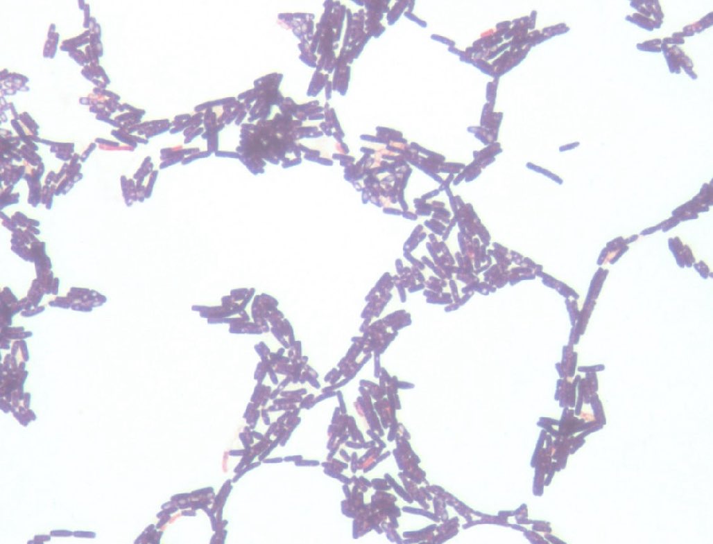 yugigenetics's tweet photo. Extracted Bacillus from the soil of my babies. Looking nice looking nice. (I work in a lab part time and was able to do this😭) https://t.co/tPAh11AoUo