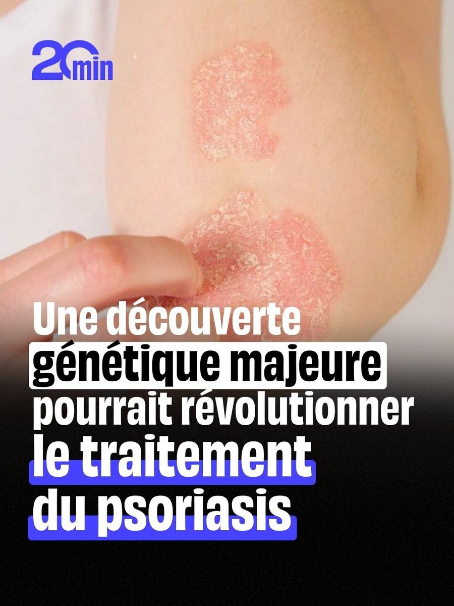 20Minutes's tweet photo. Un espoir pour les malades résistants
➡️ https://t.co/bt6e1DC7xj https://t.co/pJPGCVY5VY