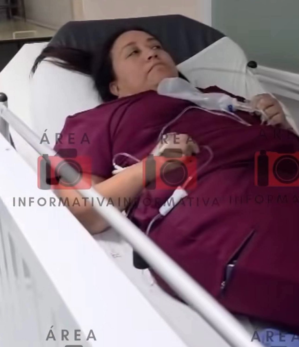 HtTrejo's tweet photo. ‼️Se desmayan doctora y dos enfermeros durante cirugía en el Hospital General de Fresnillo, Zacatecas ‼️

🛑 Una paciente originaria de Río Grande vivió momentos de tensión luego de que una doctora y dos enfermeros se desvanecieran en plena intervención quirúrgica, debido a las altas temperaturas provocadas por la falta de aire acondicionado en los quirófanos del Hospital General de Fresnillo.

De acuerdo con denuncias del personal médico, la cirujana sufrió un golpe de calor, mientras que otro integrante del equipo presentó vómito y mareos. Los tres tuvieron que ser retirados del quirófano en camillas para recibir atención médica.

Trabajadores del hospital señalaron que, en una reunión con jefes de servicio, se había acordado suspender las cirugías programadas y realizar únicamente procedimientos de urgencia debido a las condiciones de los quirófanos; sin embargo, aseguran que dicho acuerdo no fue respetado.

Hasta el momento, las autoridades de salud no han emitido un posicionamiento oficial sobre lo ocurrido ni sobre las condiciones de operación del hospital.

#Fresnillo #RíoGrande #Zacatecas #HospitalGeneral #Salud #ÚltimaHora

📷 Imágenes vía #MeganoticiasZacatecas y #AficionPolitica.