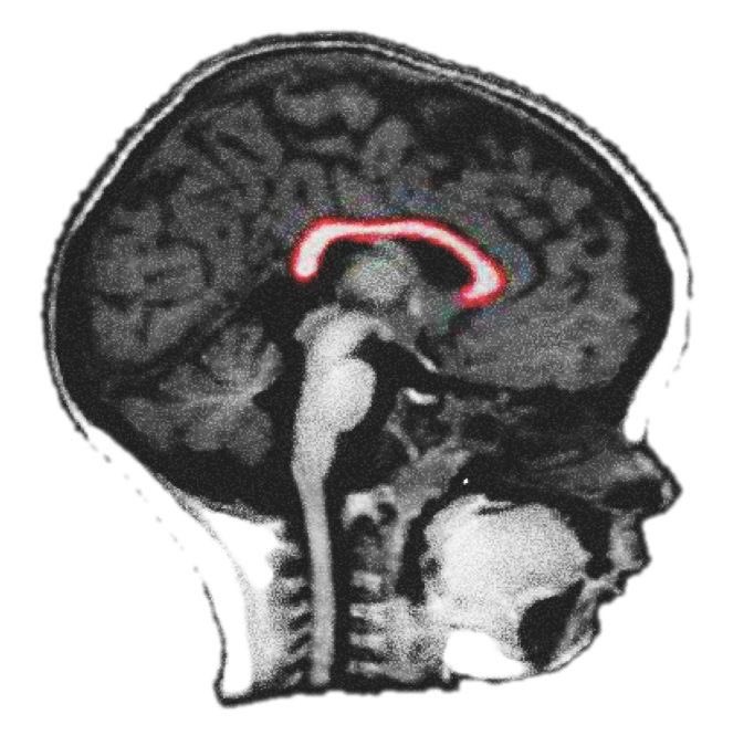 ShiningScience's tweet photo. Neurologists confirm family arguments trigger the same brain response in children as soldiers in combat.

Arguments and fights they witness at home shape their brain similar to those in high-stress situations. https://t.co/bgLNfrYoLZ
