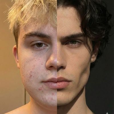 EfectoCaosX's tweet photo. Cortisol alto = grasa facial      

Si el cortisol no baja, la grasa no se va. Estas son las mejores maneras de reducirlo:      

1. Deja de hacer tanto cardio https://t.co/CExwtfzzaI