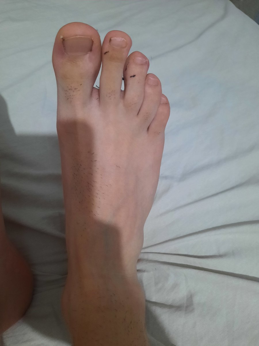 Tenri_99's tweet photo. stinky smelly boy feet. clean up https://t.co/rPwNAkKVYr