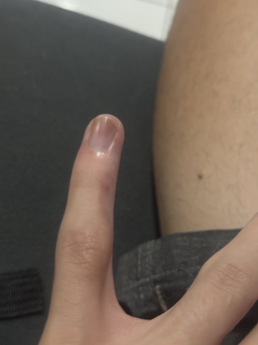 gusttmrt's tweet photo. gente o dedo de vcs também é meio amassado de segurar o celular? https://t.co/SMesO0nf3D
