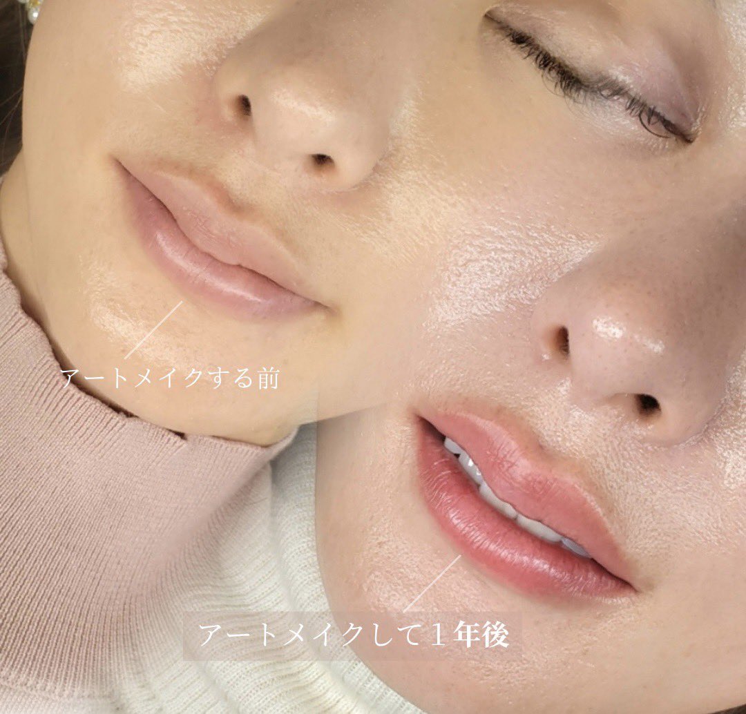 artmake_lor's tweet photo. 「アートメイクって、1年後どうなるの？」

こちらはリップアートメイク【1年後】の経過です💋

濃く残すのではなく、
時間が経っても肌になじむ色味を意識して
一人ひとりに合わせてカラーを選定しています。

“何もしていないのに、なんだか綺麗”
そんな唇を目指したリップアートメイクです。 https://t.co/Ty2RcabOQv