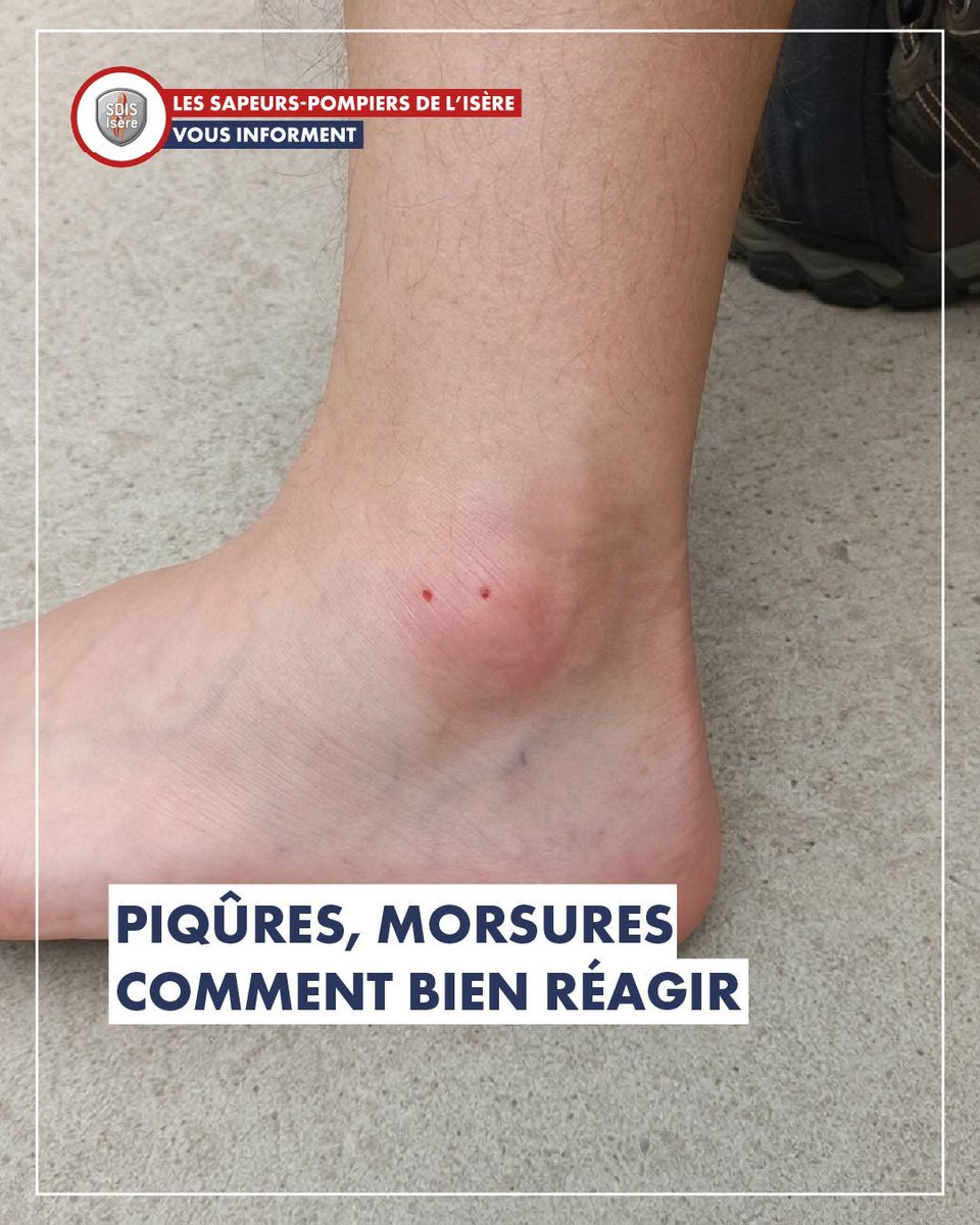 sdis38's tweet photo. #ÉtéEnSécurité | Petites bêtes, grandes gênes !
Piqûres et morsures peuvent vite gâcher vos sorties 🦟🌿
Restez vigilants pour profiter sereinement ! https://t.co/SKbxs4cvqS