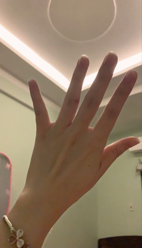 daniel81397032's tweet photo. Sunlit hand, tiny details doing the talking a bracelet, soft glow, and a moment of calm
RfLd https://t.co/nt61Ls9WLM