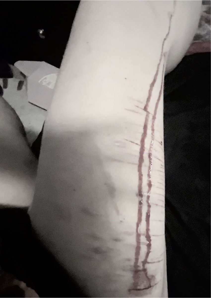 edtwtmix's tweet photo. i want him to slash my chest open over and over again, he can take my heart. https://t.co/uUT9aAh71m